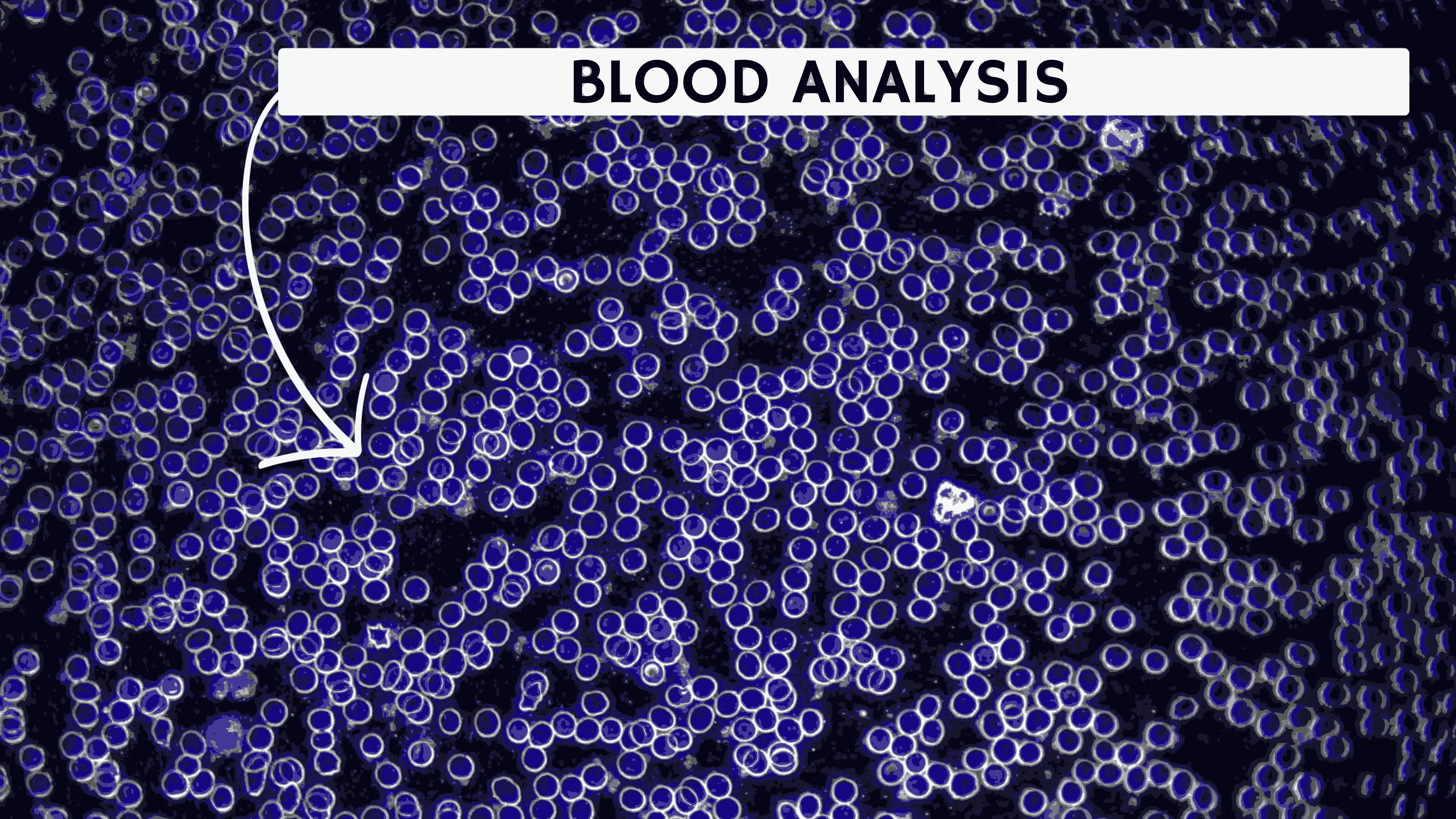 Blood Analysis